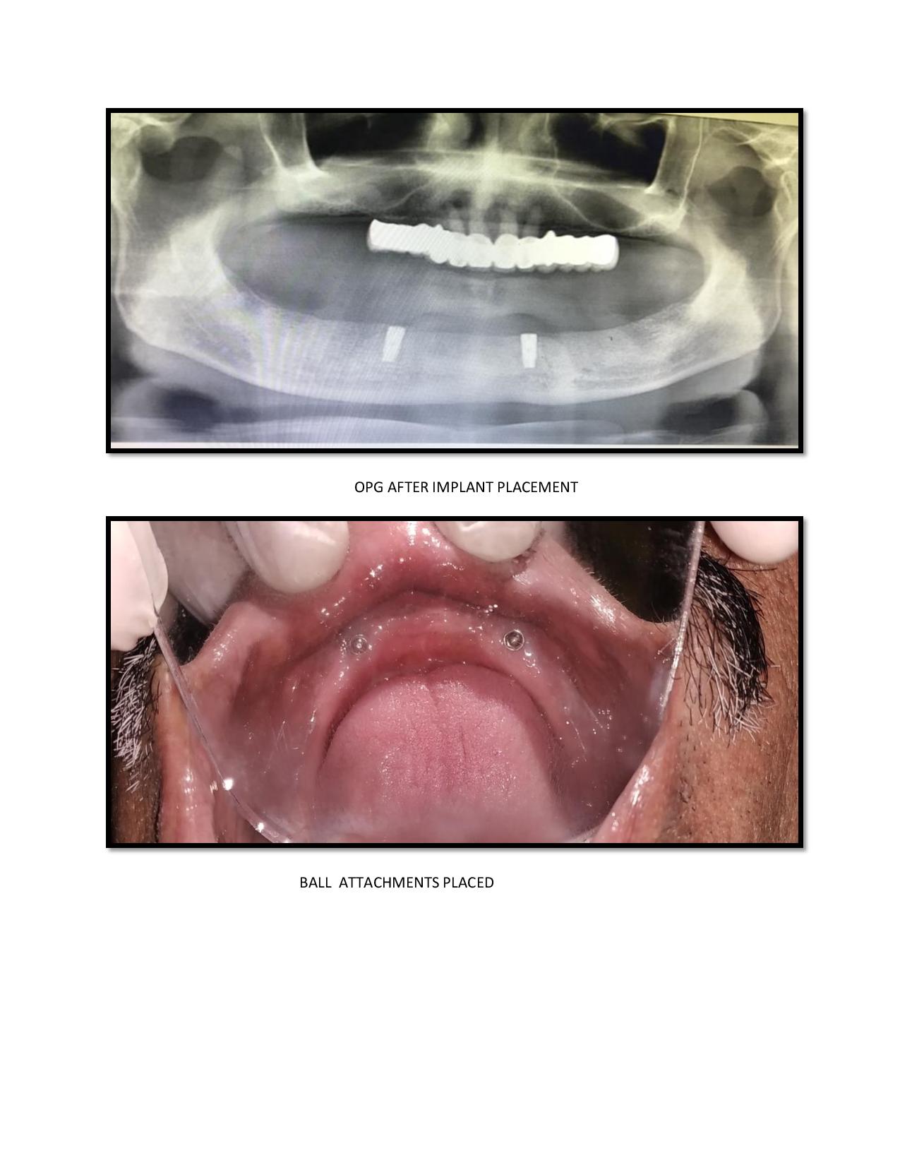 case report for the department of prosthodontics in the section of health informatics